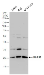 Anti-NDUFS3 antibody used in Western Blot (WB). GTX113504