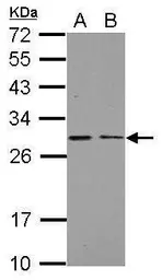 Anti-NDUFS3 antibody used in Western Blot (WB). GTX113504