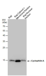 Anti-Cyclophilin A antibody [N1C3] used in Western Blot (WB). GTX113520
