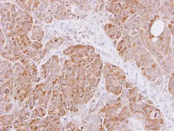 Anti-Cyclophilin A antibody [N1C3] used in IHC (Paraffin sections) (IHC-P). GTX113520