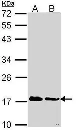 Anti-Cyclophilin A antibody [N1C3] used in Western Blot (WB). GTX113520