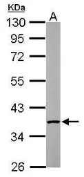 Anti-PP2A alpha antibody used in Western Blot (WB). GTX113523