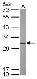 Anti-PSMA7 antibody [N1C2] used in Western Blot (WB). GTX113531