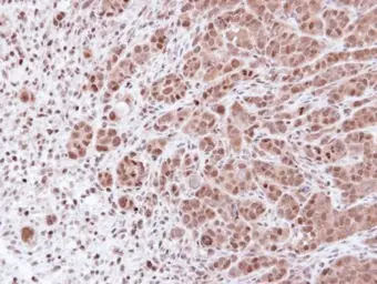 Anti-PSMA7 antibody [N1C2] used in IHC (Paraffin sections) (IHC-P). GTX113531