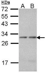Anti-PSMA7 antibody [N1C2] used in Western Blot (WB). GTX113531