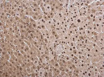 Anti-PSMB8 antibody [N2C3] used in IHC (Paraffin sections) (IHC-P). GTX113533