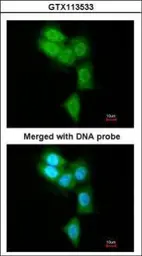 Anti-PSMB8 antibody [N2C3] used in Immunocytochemistry/ Immunofluorescence (ICC/IF). GTX113533