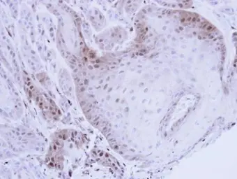 Anti-PSMB8 antibody [N2C3] used in IHC (Paraffin sections) (IHC-P). GTX113533