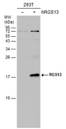 Anti-RGS13 antibody [N1C3] used in Western Blot (WB). GTX113540