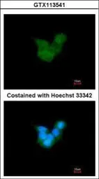 Anti-CRALBP antibody [N2C3] used in Immunocytochemistry/ Immunofluorescence (ICC/IF). GTX113541