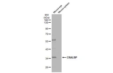 Anti-CRALBP antibody [N2C3] used in Western Blot (WB). GTX113541