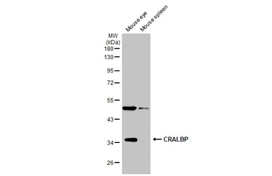 Anti-CRALBP antibody [N2C3] used in Western Blot (WB). GTX113541