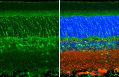 Anti-CRALBP antibody [N2C3] used in IHC (Paraffin sections) (IHC-P). GTX113541