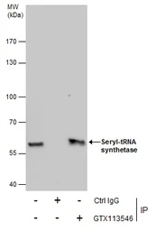 Anti-Seryl-tRNA synthetase antibody [N1C2] used in Immunoprecipitation (IP). GTX113546
