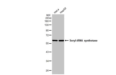 Anti-Seryl-tRNA synthetase antibody [N1C2] used in Western Blot (WB). GTX113546