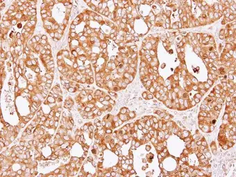 Anti-Seryl-tRNA synthetase antibody [N1C2] used in IHC (Paraffin sections) (IHC-P). GTX113546