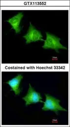 Anti-SPR antibody [N2C3] used in Immunocytochemistry/ Immunofluorescence (ICC/IF). GTX113552
