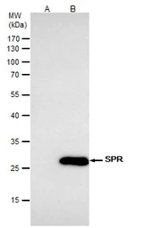 Anti-SPR antibody [N2C3] used in Immunoprecipitation (IP). GTX113552