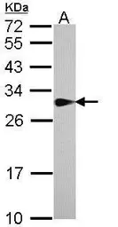 Anti-SPR antibody [N2C3] used in Western Blot (WB). GTX113552