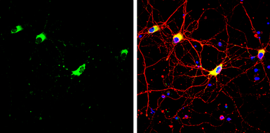 Anti-STIM1 antibody used in Immunocytochemistry/ Immunofluorescence (ICC/IF). GTX113558