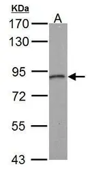 Anti-STIM1 antibody used in Western Blot (WB). GTX113558