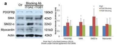 Anti-Transgelin antibody used in Western Blot (WB). GTX113561