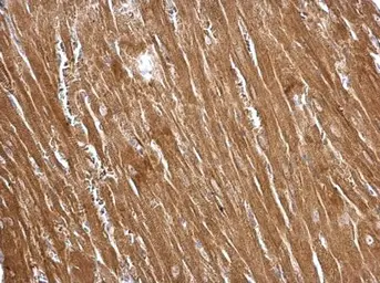 Anti-Transgelin antibody used in IHC (Paraffin sections) (IHC-P). GTX113561
