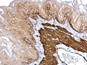 Anti-Transgelin antibody used in IHC (Paraffin sections) (IHC-P). GTX113561