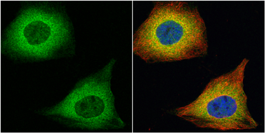 Anti-Transgelin antibody used in Immunocytochemistry/ Immunofluorescence (ICC/IF). GTX113561