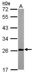 Anti-Transgelin antibody used in Western Blot (WB). GTX113561