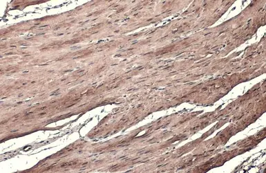 Anti-Transgelin antibody used in IHC (Paraffin sections) (IHC-P). GTX113561