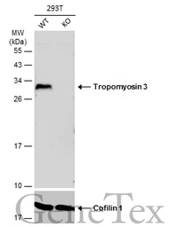 Anti-Tropomyosin 3 antibody [N2C3] used in Western Blot (WB). GTX113568