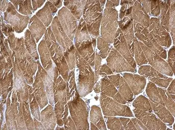 Anti-Tropomyosin 3 antibody [N2C3] used in IHC (Paraffin sections) (IHC-P). GTX113568