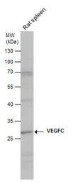 Anti-VEGFC antibody used in Western Blot (WB). GTX113574