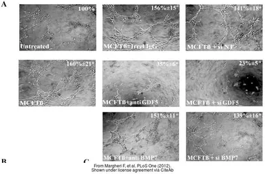 Anti-GDF5 antibody used in Functional Assay (Functional Assay). GTX113580