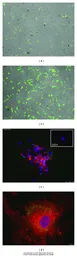 Anti-GDF5 antibody used in Immunocytochemistry/ Immunofluorescence (ICC/IF). GTX113580