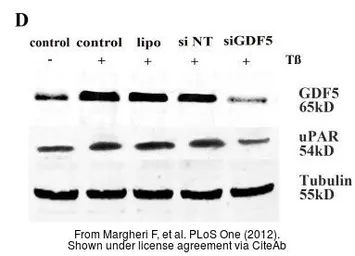 Anti-GDF5 antibody used in Western Blot (WB). GTX113580