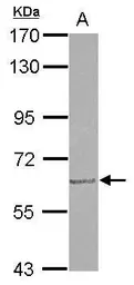 Anti-GDF5 antibody used in Western Blot (WB). GTX113580