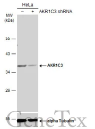 Anti-AKR1C3 antibody [N1C1] used in Western Blot (WB). GTX113586