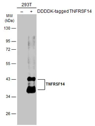 Anti-TNFRSF14 antibody [N2C3] used in Western Blot (WB). GTX113589