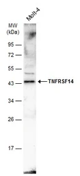Anti-TNFRSF14 antibody [N2C3] used in Western Blot (WB). GTX113589