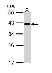 Anti-EIF2B beta antibody [N2C3] used in Western Blot (WB). GTX113590