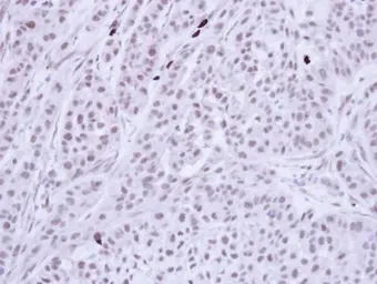 Anti-BUB3 antibody [N1C1] used in IHC (Paraffin sections) (IHC-P). GTX113595
