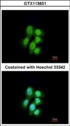 Anti-MVP/LRP antibody used in Immunocytochemistry/ Immunofluorescence (ICC/IF). GTX113601