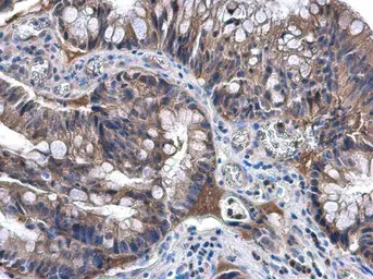 Anti-NAT1 antibody [N1C1] used in IHC (Paraffin sections) (IHC-P). GTX113619