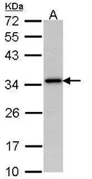 Anti-NAT1 antibody [N1C1] used in Western Blot (WB). GTX113619