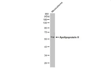 Anti-Apolipoprotein H antibody [N1C2] used in Western Blot (WB). GTX113627
