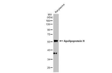 Anti-Apolipoprotein H antibody [N1C2] used in Western Blot (WB). GTX113627