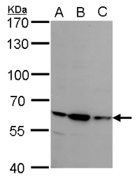 Anti-Steroid sulfatase antibody used in Western Blot (WB). GTX113628