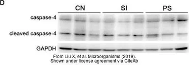 Anti-Caspase 4 antibody used in Western Blot (WB). GTX113639
